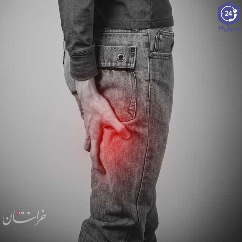 برای بهبود سیاتیک چه کارهایی انجام دهیم؟
