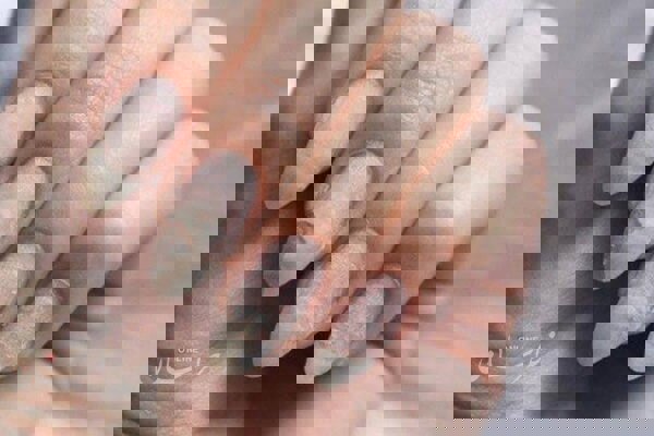 تغییر رنگ ناخنها نشانه چیست؟